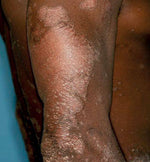 Charger l&#39;image dans la galerie, pommade antibactérienne
