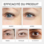 Charger l&#39;image dans la galerie, sérum ou roll-on pour le contour du visage
